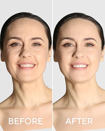 whitening dark spot