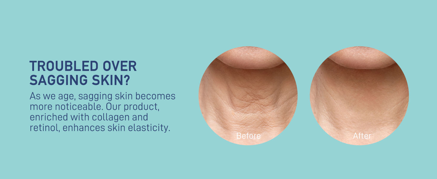 trouble over sagging skin?