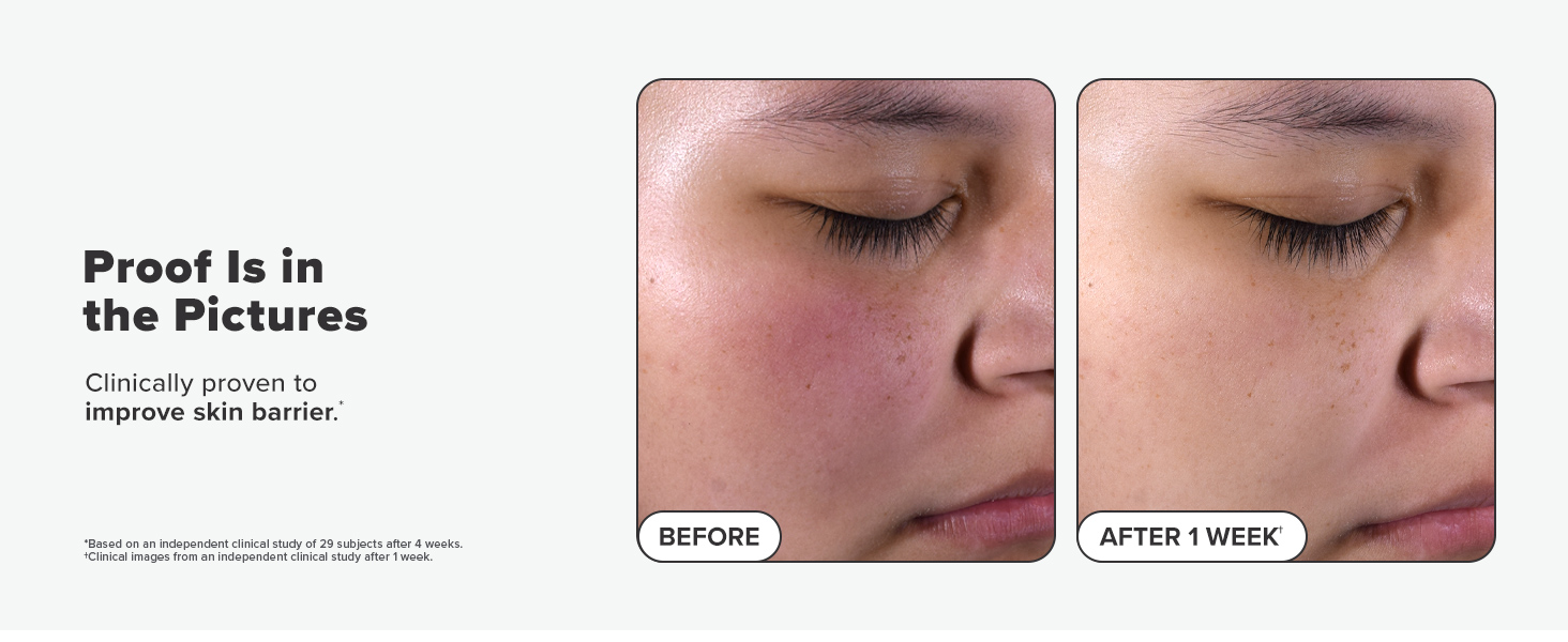 2% BHA Liquid Pads