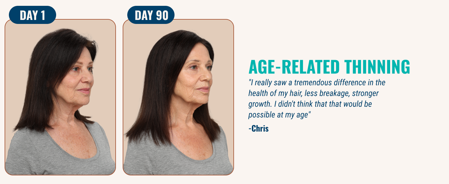 age-related thinning