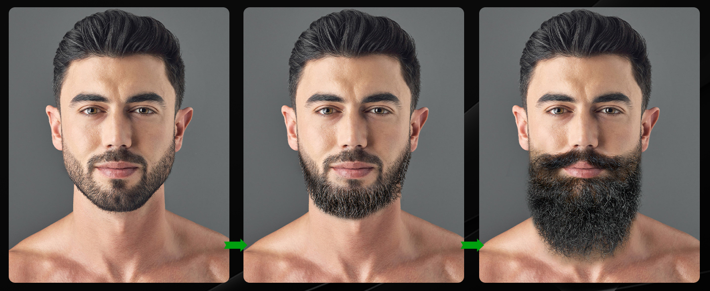 beard growth