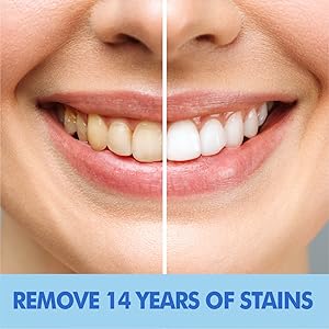 teeth whiten