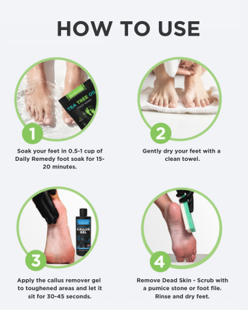 Daily Remedy Callus Gel Remover Foot Soak Set Kit