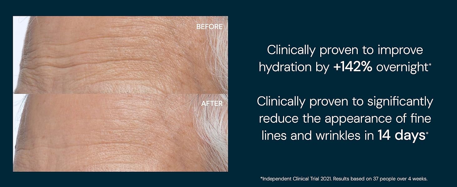 improves hydration, reduces appearance of fine lines and wrinkles