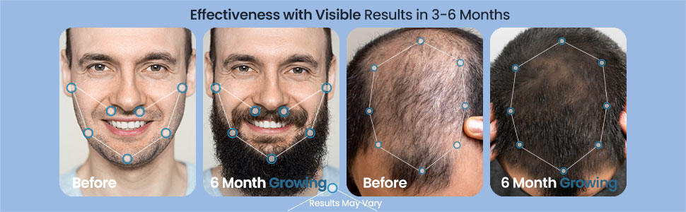 hair regrowth treatment