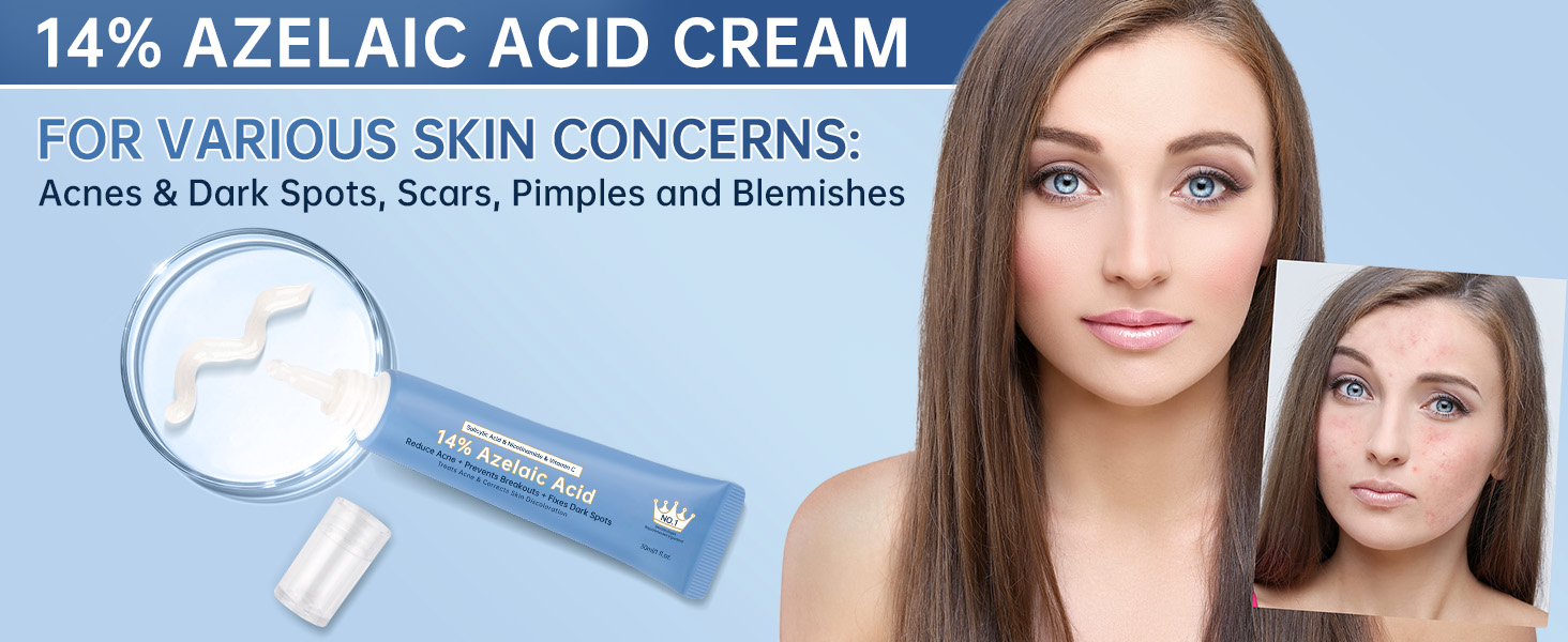 14% Azelaic Acid Cream