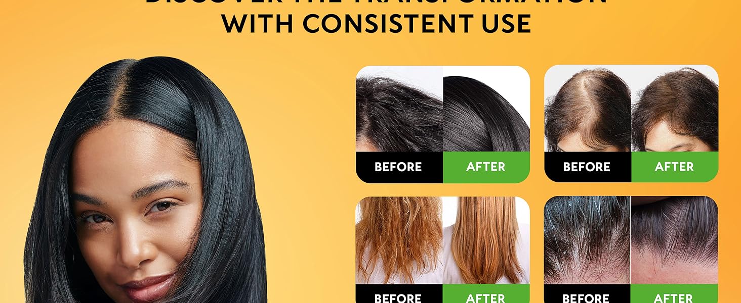 batana oil for hair growth