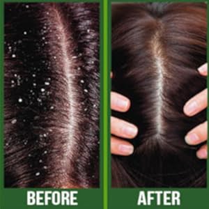 Before/After