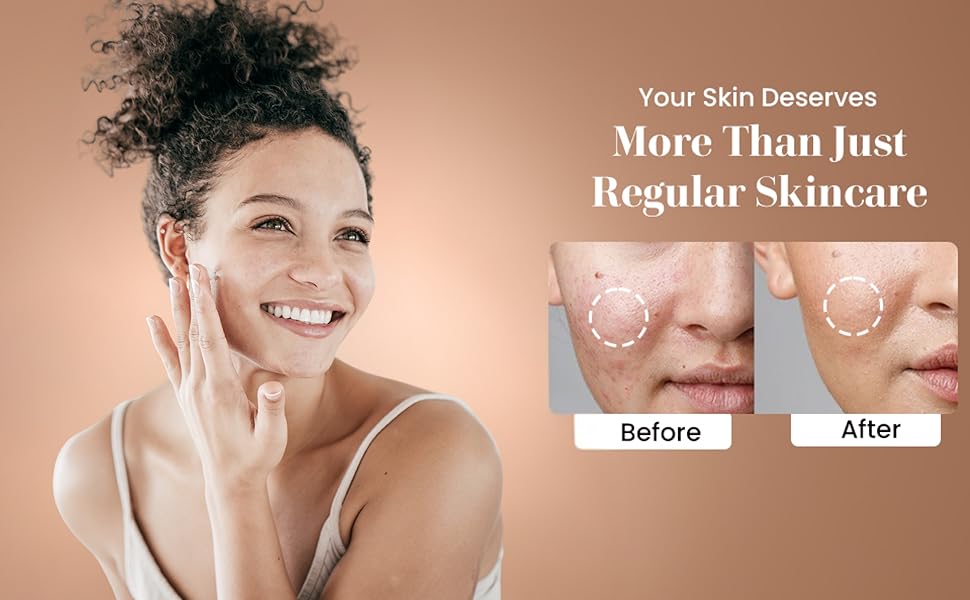 Organic moisturizer results Nourishing cream for smooth skin Anti-inflammatory