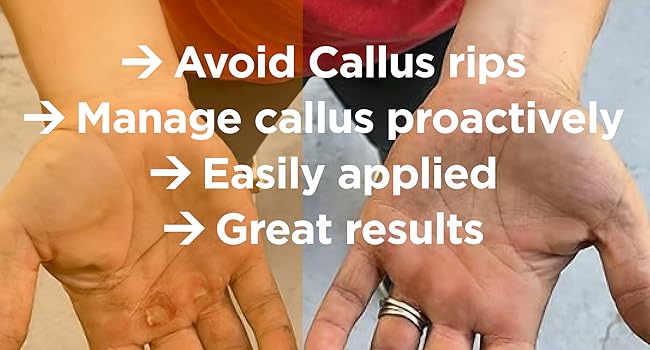 hand callus remover hands crossf pumice stone curad wart pretty feet rough skin original