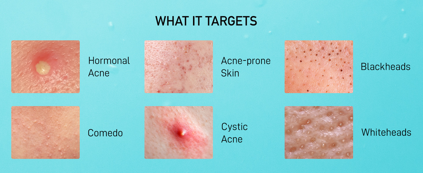 What it targets