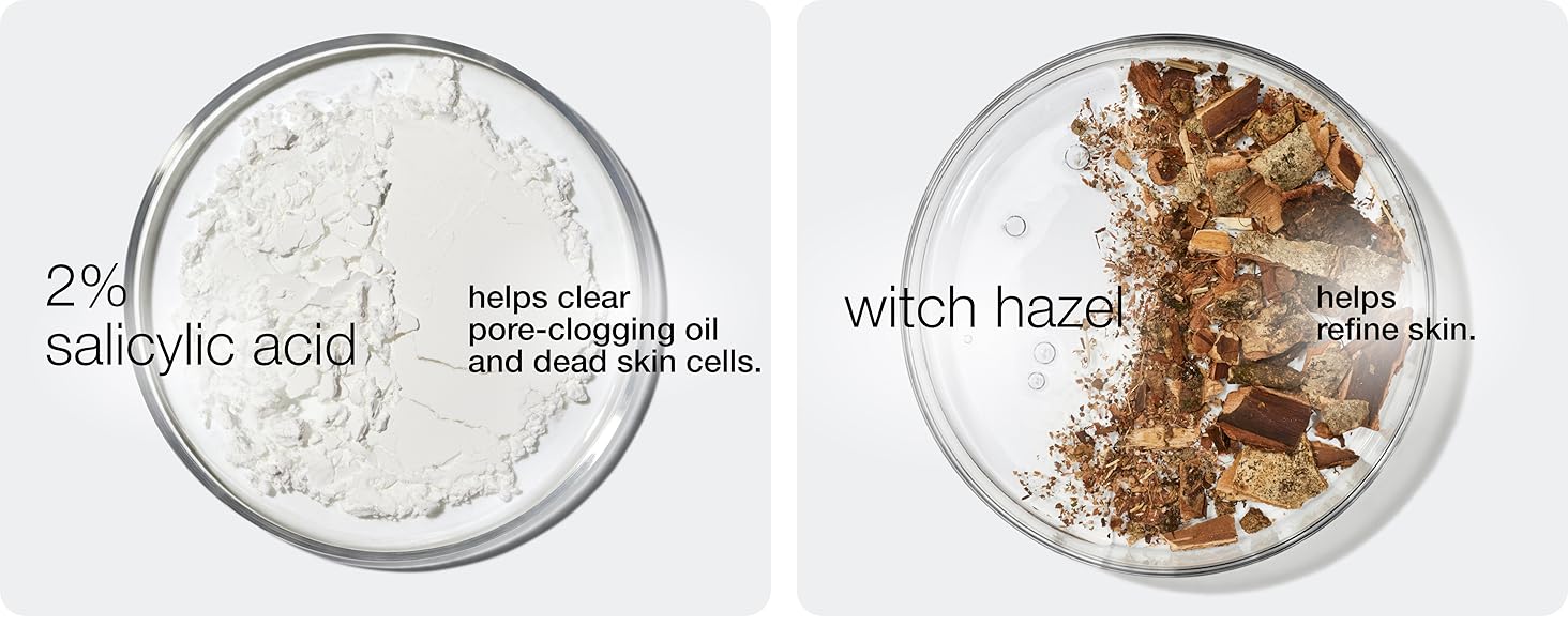 Acne Solutions Clearing Gel