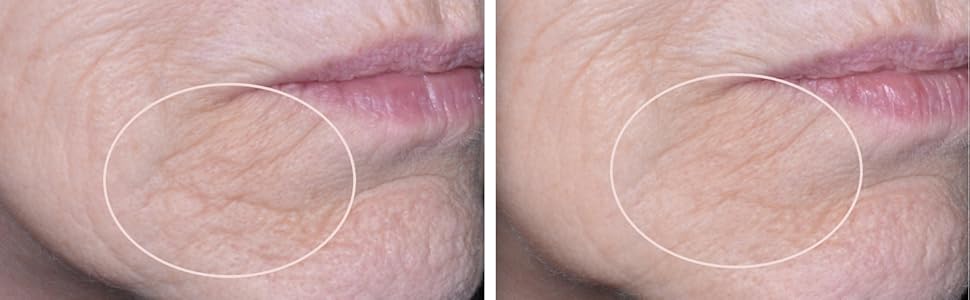 Stem​ Cell Face Cream Before &amp; After
