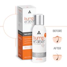 Bump Eraiser Triple Action Lotion