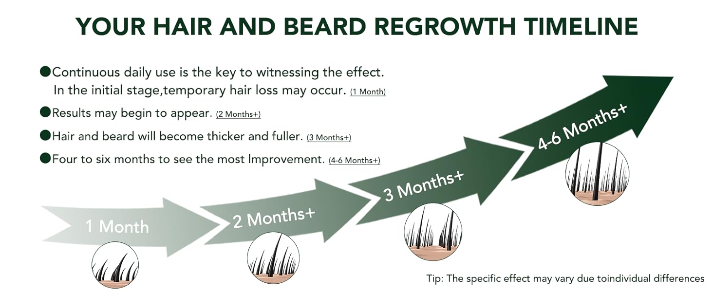 minoxidil for women