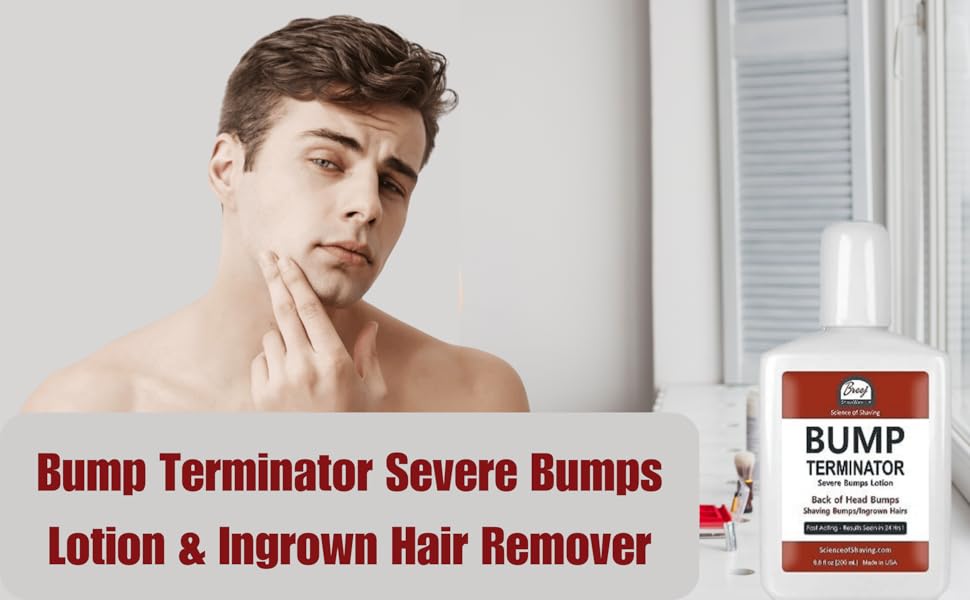 rapid remover, aftershave for men ingrown hair, after shave no bumps, bump stopper 2
