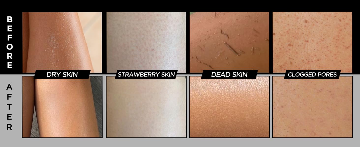 dissolving pretty scubber ultra-hydrating glowing radiance net backbrush nightly exfoliation shwoer