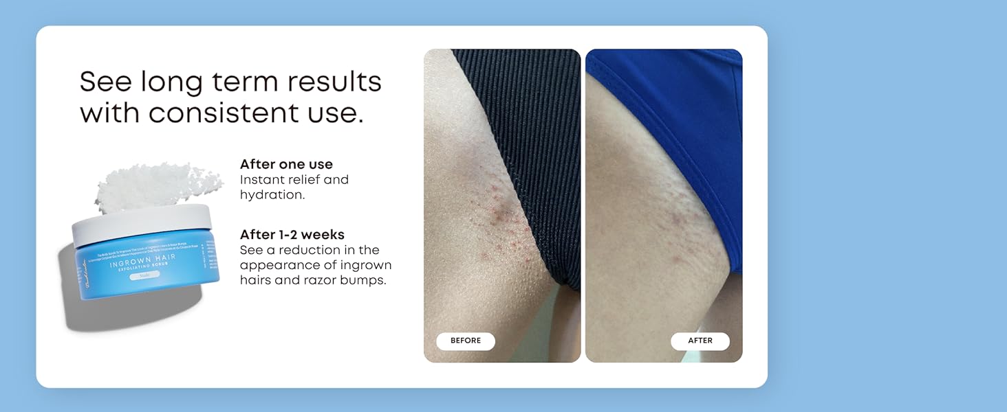 See + Feel Results