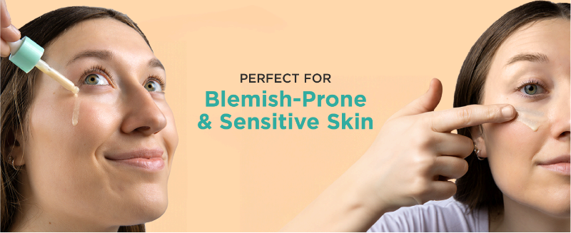 Perfect for Blemish-Prone & Sensitive Skin