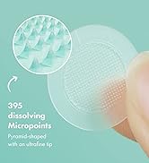 micropoints
