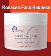 e70 Rosacea Solve