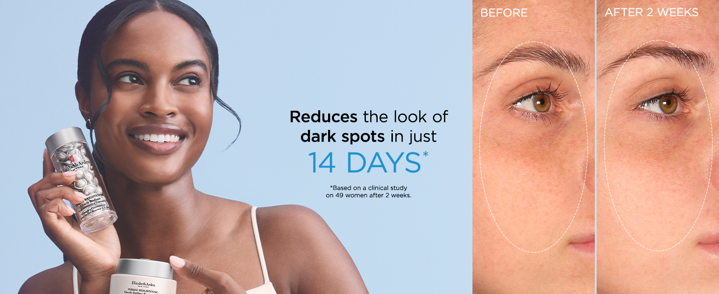 Visible Brightening Before and After