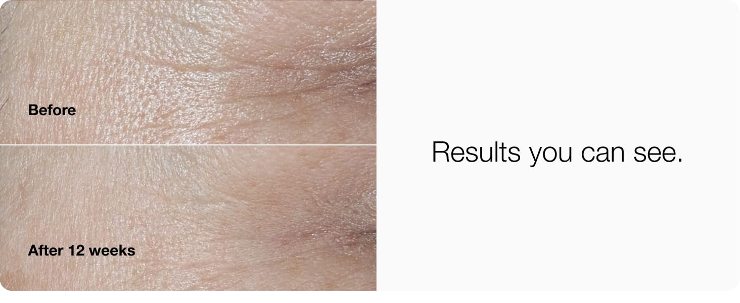 aplus content image