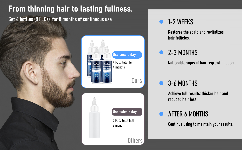 minoxidil hair growth serum for men
