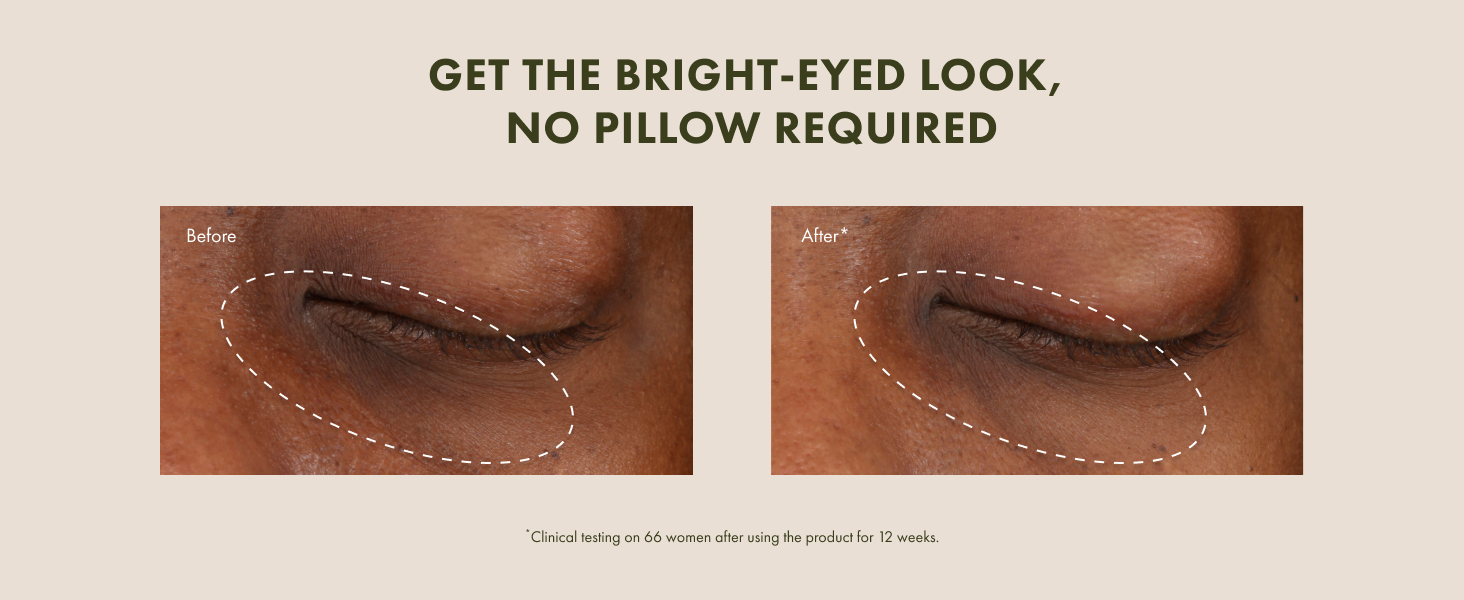 Ginzing Eye Cream