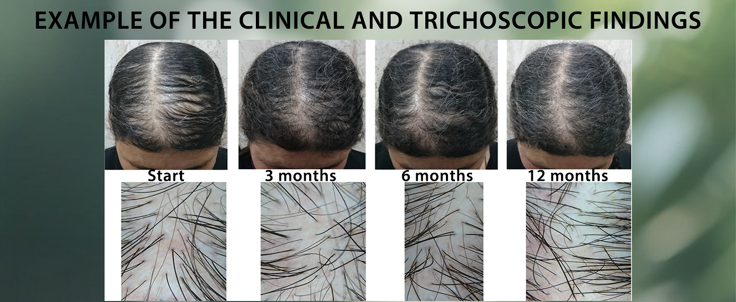hair growth products