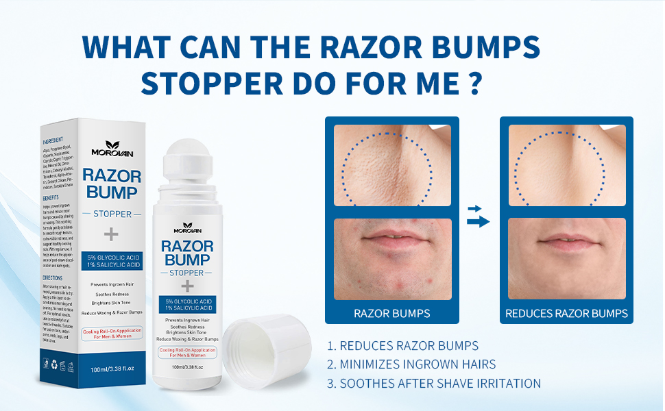 razor bump