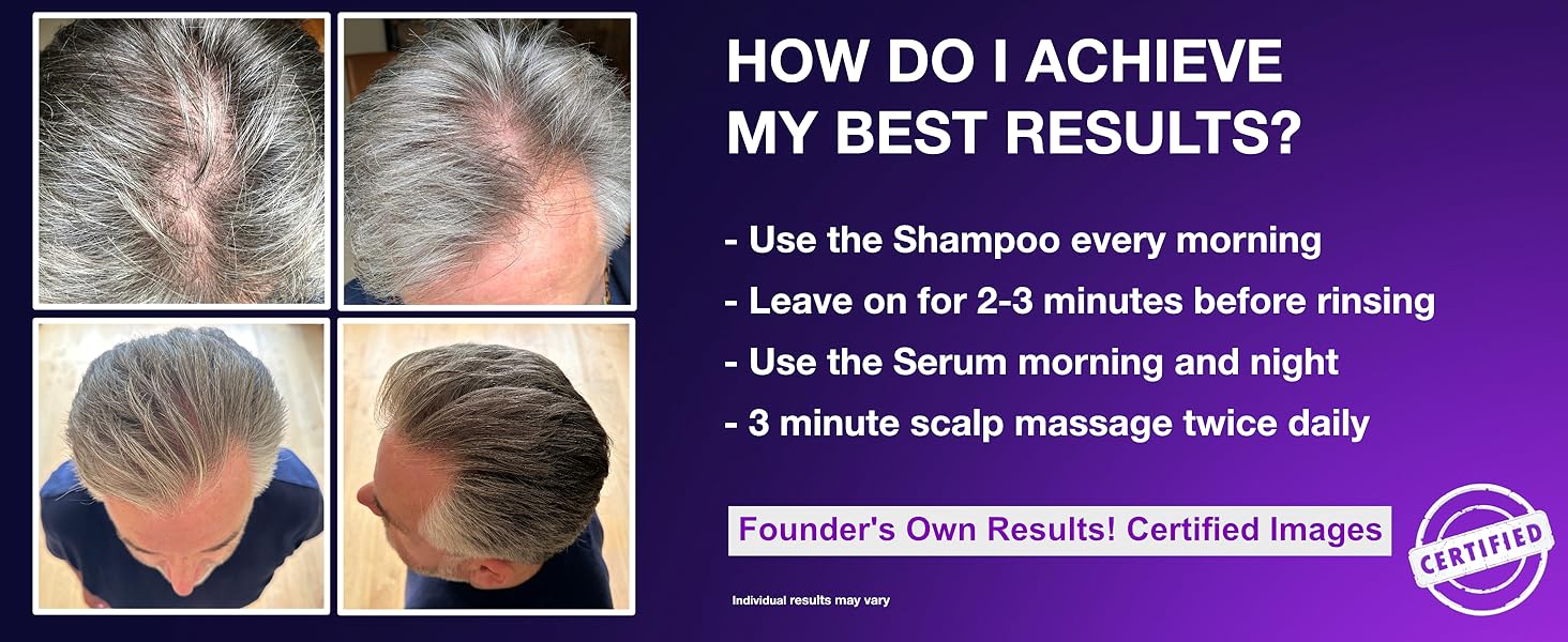 Guyology Labs Maximum Hair Growth Serum, Biotin, Saw Palmetto, Hair Loss, Regrowth, Hair Thinning,