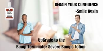 razor bump remover, razor bump solution, razor bump treatment men, ingrown hair treatment