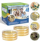 Rylenor DIY Mold Test Kit for Home, Black Mold Testing Kit with 6 Individual Tests -Home Mold Air...