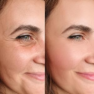 face Anti aging cream