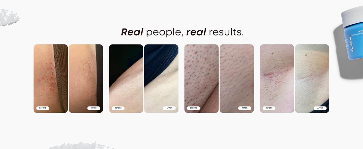 Before + After Results