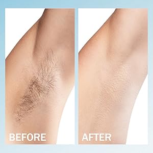 Hair Removal Wax Beans