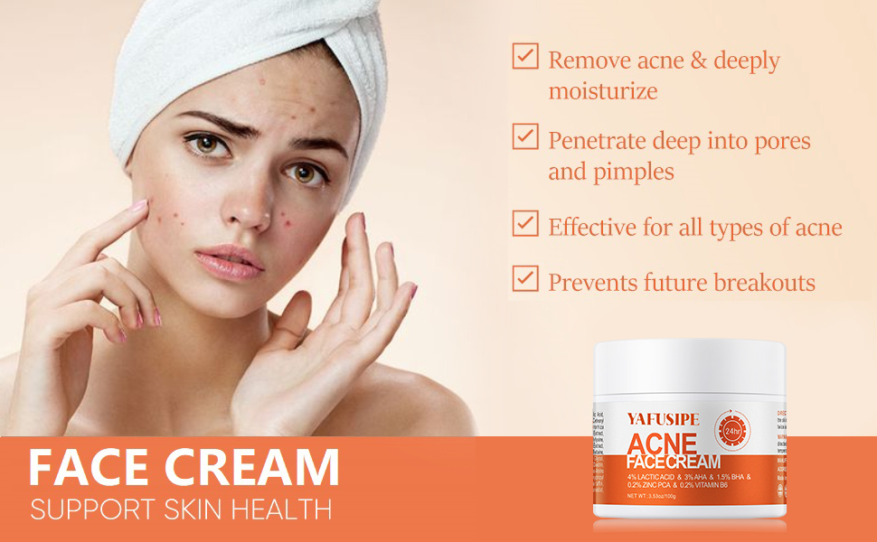 acne face cream acne treatment for teens acne treatment for sensitive skin  acne treatment