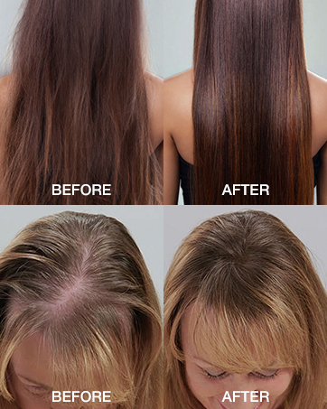 batana oil shampoo for hair growth