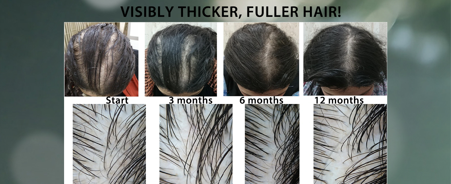 hair growth products