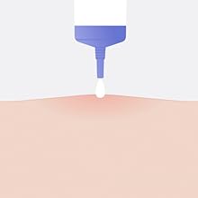Apply Rescue Balm the first and only post-pimple treatment
