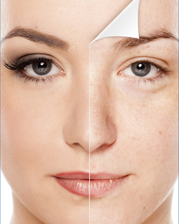 Skin Care
