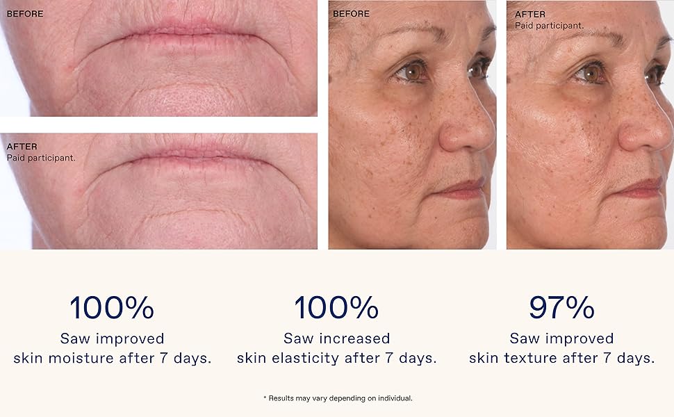 Saw improved skin moisture, increased skin elasticity, and improved skin texture after 7 days.