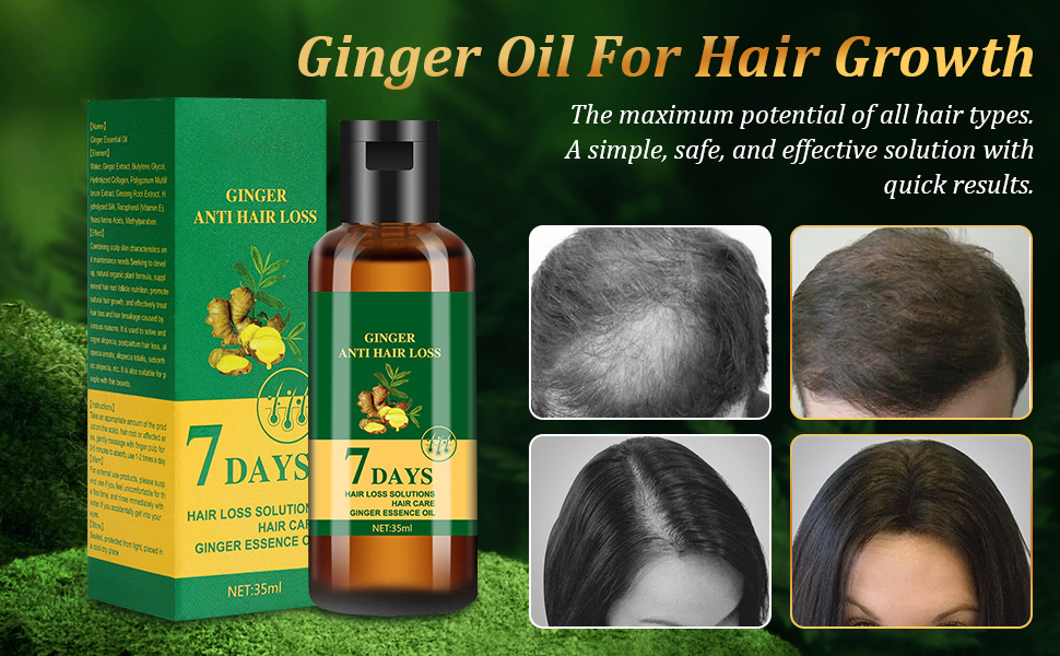 2Pcs Ginger Anti Hair Loss Oil