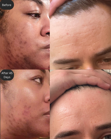 Image of dark spots treatment and anti aging serum effects.