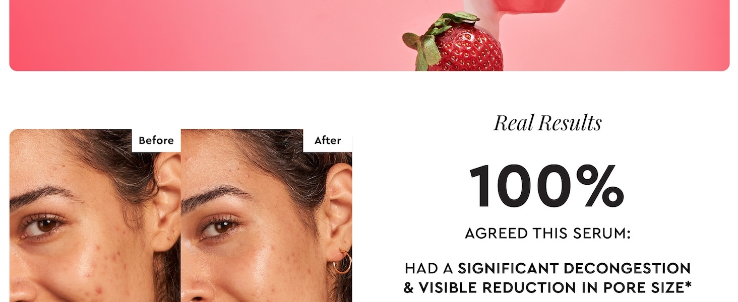 reduce pore size, oily skin