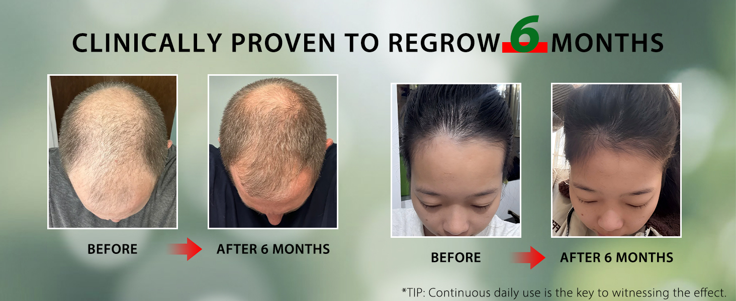 hair growth products
