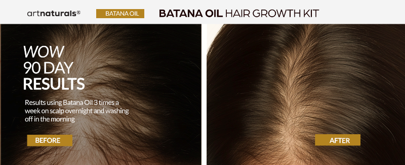 Batana oil artnaturals hair growth kit