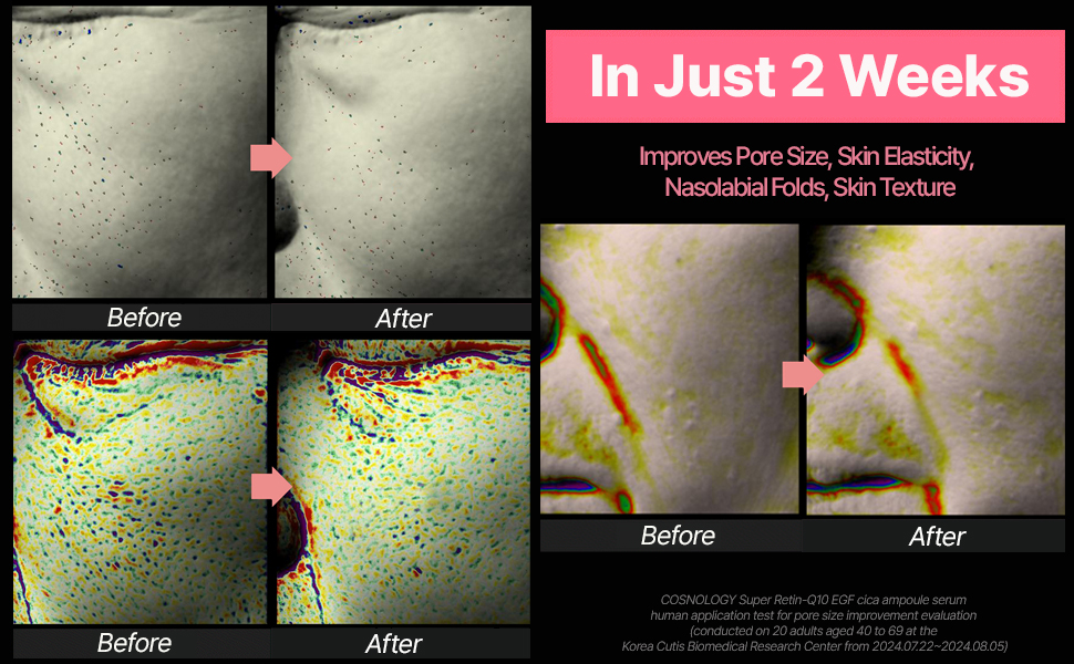 Pore Serum_03