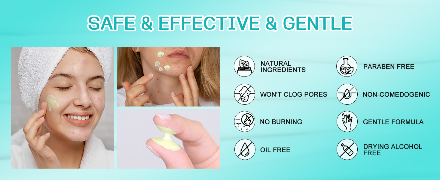 Acne Cream
